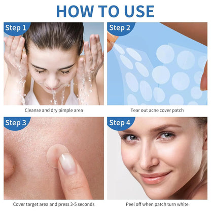 Pimple Patches for Face, Hydrocolloid Acne Patches, Hydrocolloid Patches for Covering Zits and Blemishes, Spot Stickers