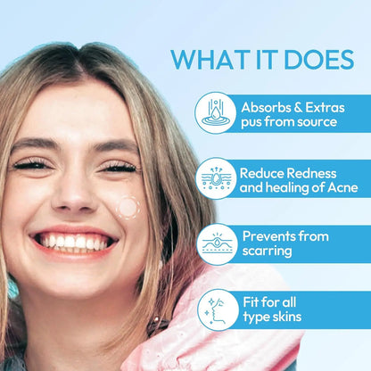 Pimple Patches for Face, Hydrocolloid  Acne Patches, Hydrocolloid Patches for Covering Zits and Blemishes, Spot Stickers