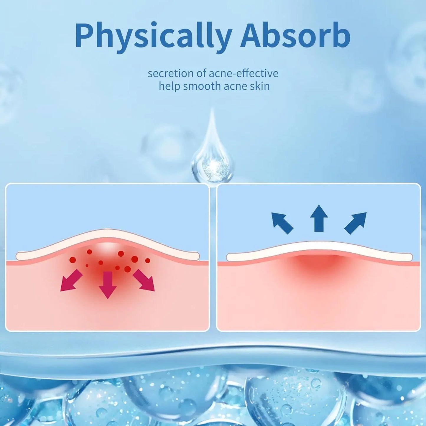 Pimple Patches for Face, Hydrocolloid Acne Patches, Hydrocolloid Patches for Covering Zits and Blemishes, Spot Stickers