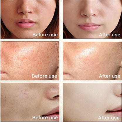Korean Skincare Anti-Aging Face Cream Moisturizing Brighten Reduce Melanin Wrinkle Control Oil Shrink Pores Whitening for Unisex