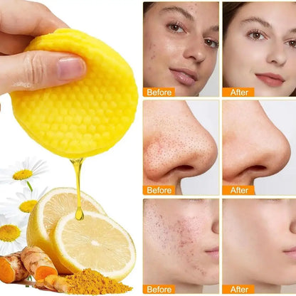 40/50pcs Kojic Acid Turmeric Cleansing Pads Curcuma Longa Root Facial Sponges Exfoliating Pads Daily Cleansing Skin Care Product
