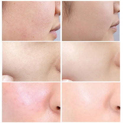 Korean Skincare Anti-Aging Face Cream Moisturizing Brighten Reduce Melanin Wrinkle Control Oil Shrink Pores Whitening for Unisex